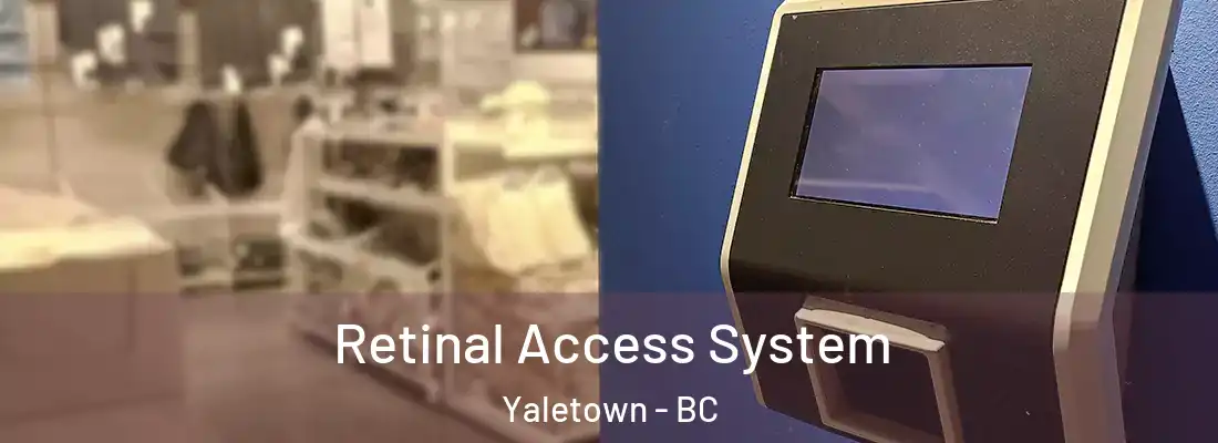  Retinal Access System Yaletown - BC